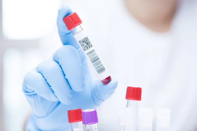 Pemeriksaan Hepatitis Anti HBc IgM/ DIAGNOSE di Emyu Healthcare