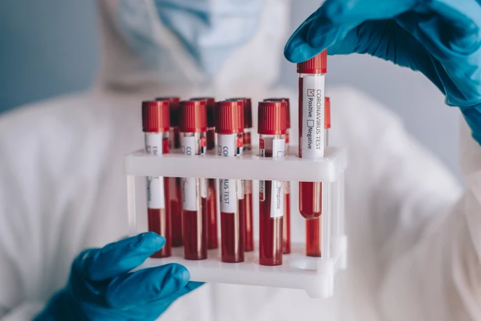 Pemeriksaan Diabetes C-Peptide di Emyu Healthcare