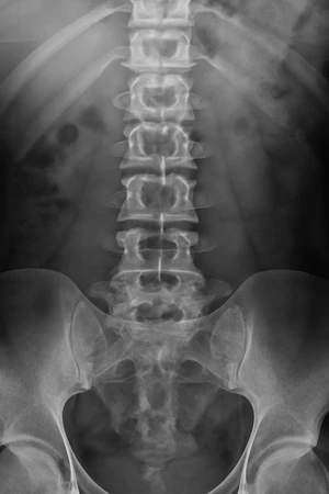 Rontgen Lumbal di Amalia Medical Center