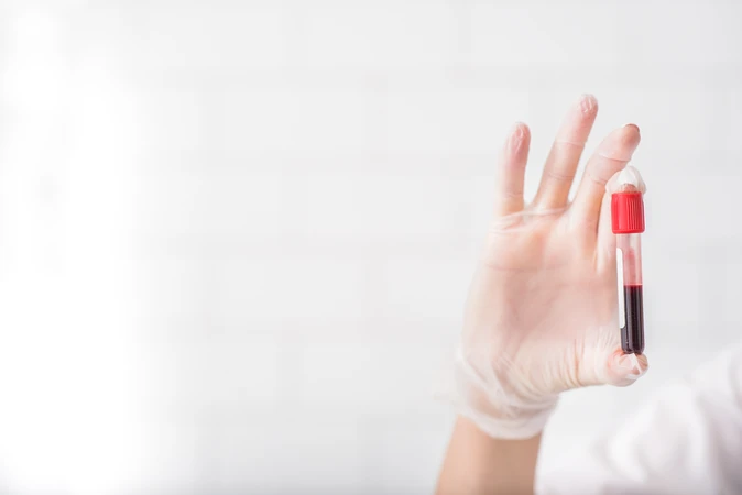 Pemeriksaan Autoimmune ACA IgG di C-Lab