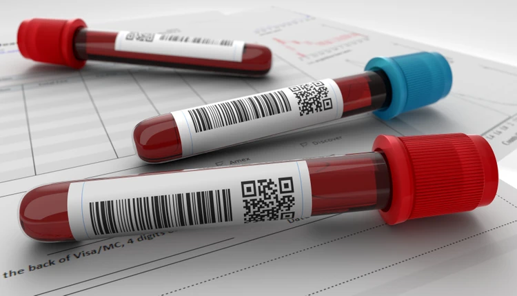 Pemeriksaan Ginjal Hipertensi Mikroalbumin (Urine 24 jam) di C-Lab