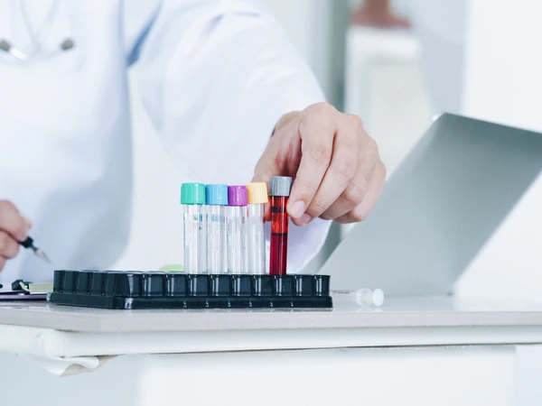 Pemeriksaan Infeksi Lain Dengue IgG/IgM di C-Lab