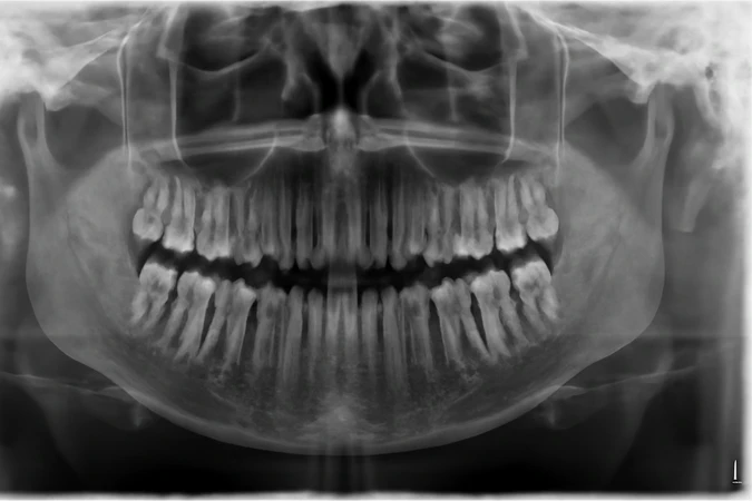 Rontgen Panoramic & Cephalometri di HiDental Serpong