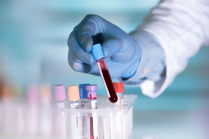 Pemeriksaan Waktu Protrombin (PT/INR) di ScanMe Labs