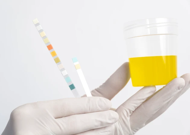 Pemeriksaan Mikroalbumin Urine 24 Jam di ScanMe Labs