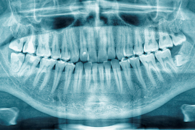 Rontgen Panoramic di Primera Dental | HDmall