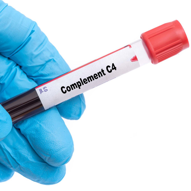 Pemeriksaan C4 Complement di Amalia Medical Center | HDmall