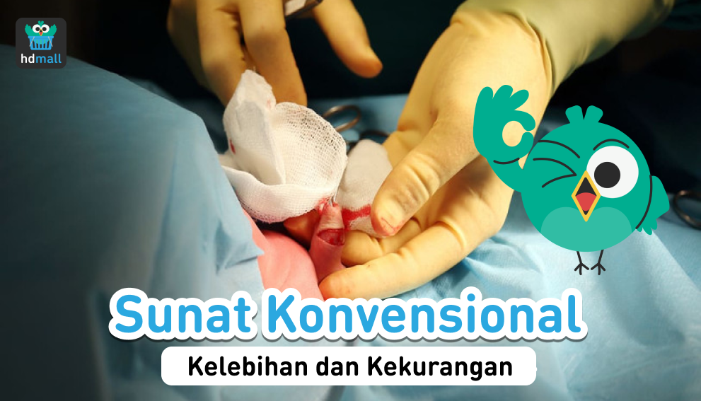 Sunat Metode Konvensional Atau Gun Stapler News Visi 