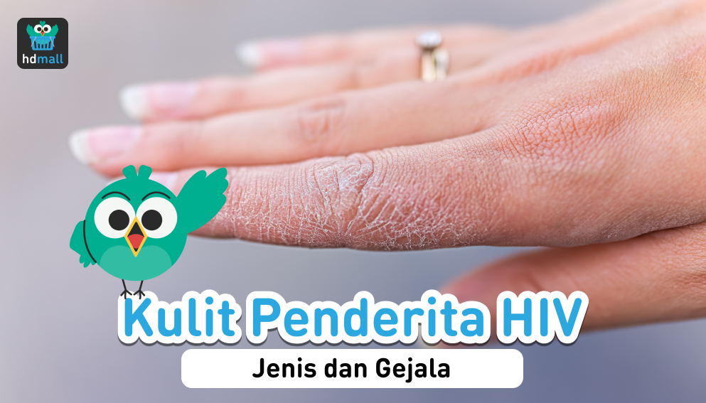 10 Masalah Kulit Penderita Hiv Kenali Ciri Cirinya Hdmall