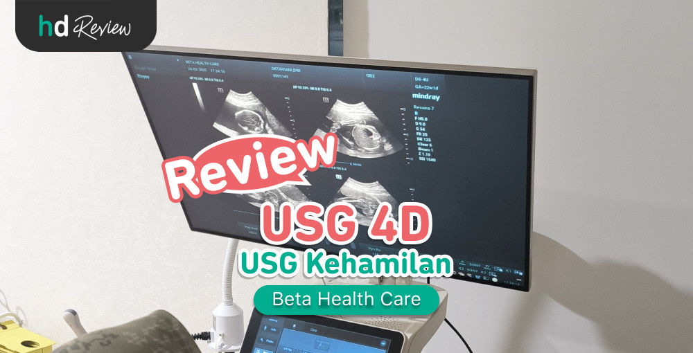 Review USG 4D di Beta Health Care | HDmall